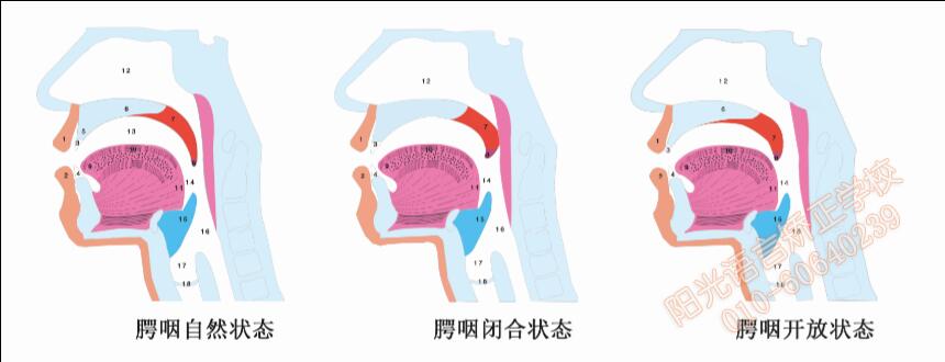 腭咽狀態(tài)